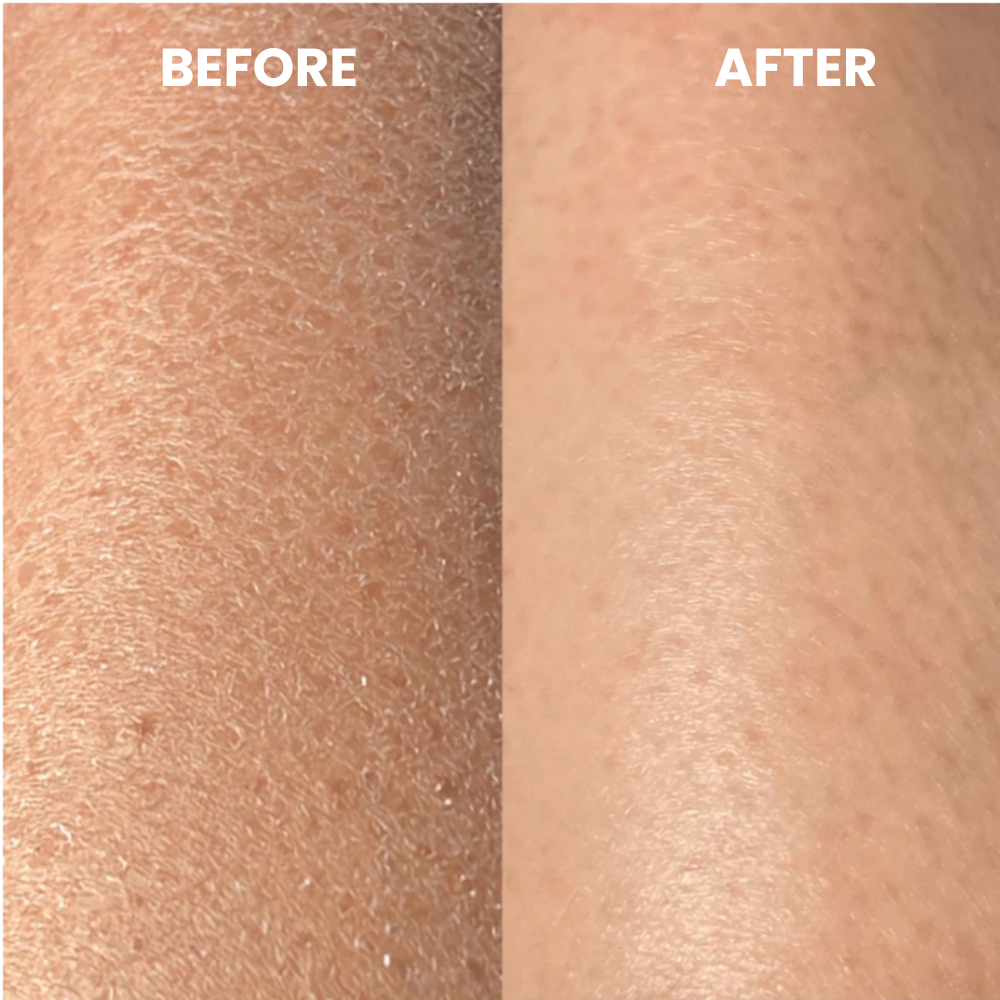 ClearGlow™ Exfoliating Glove