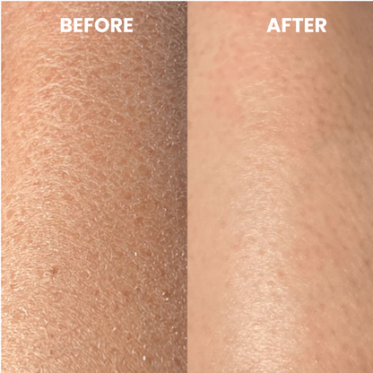 ClearGlow™ Exfoliating Glove