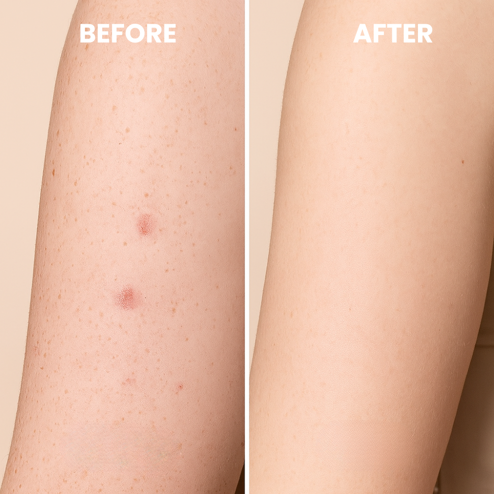 ClearGlow™ Exfoliating Glove